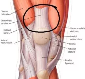 vastus-medialis-1.webp