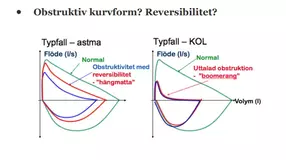 Astma_Kol.webp